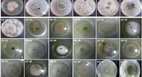 medical microbiology dissertation