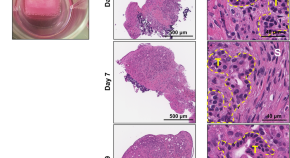 article about cancer research