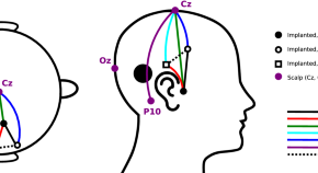 research topics for neurology