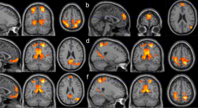 research articles neuroscience
