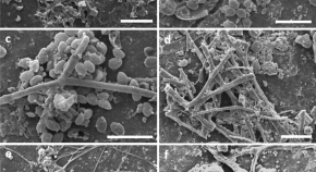 medical microbiology research topics