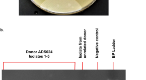 research topics about microbiology