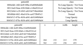 Mental distress and associated factors among college students in Kemisie  district, Ethiopia