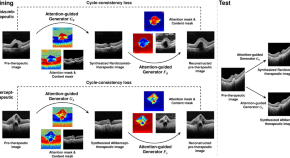 An improved plastination method for strengthening bamboo culms