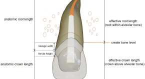 recent library dissertation topics in prosthodontics