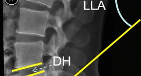 latest research topics in neurosurgery