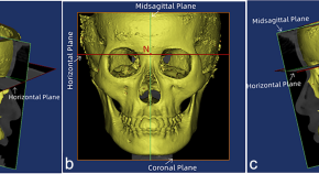 paper presentation topics for oral medicine and radiology