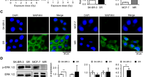 research news breast cancer