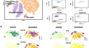 new research dementia alzheimer's