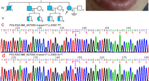 new research on genetic conditions