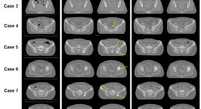 x ray research