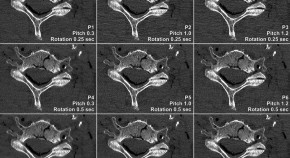 research topic in radiology