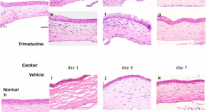 interesting diseases for research paper