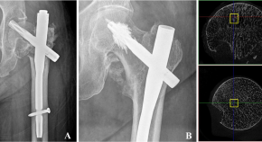 research topics in orthopaedics physiotherapy