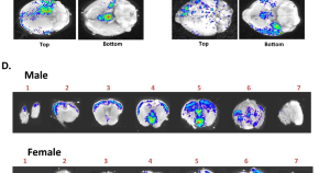 prostate cancer research