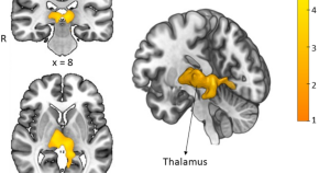 trauma research articles