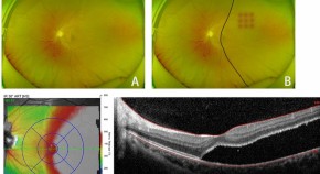 recent research reports