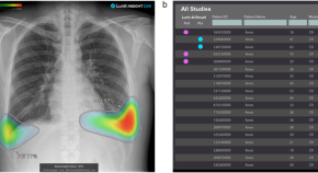 research topics for mri