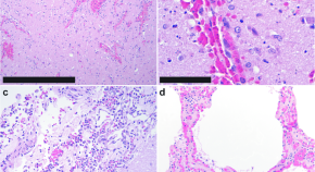 research topics in diseases