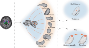 epilepsy research