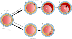 research articles cardiovascular disease