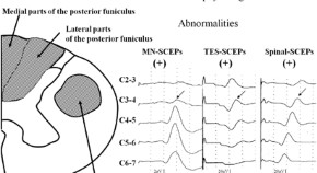 Research articles