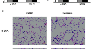 Sodium butyrate alleviates R97-116 peptide-induced myasthenia