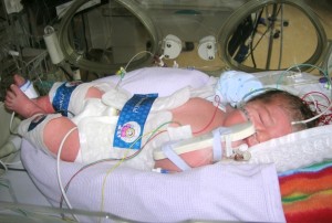 Cooling protects oxygen-deprived infants | Nature