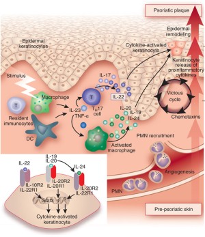 New Anti Il 23 Drugs Raise Hopes For Psoriasis Plaque Clearance Nature Biotechnology