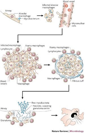 Who puts the tubercle in | Nature Reviews Microbiology
