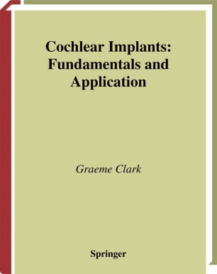 Cochlear Implants Springerlink