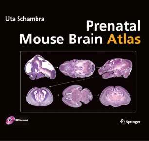Prenatal Mouse Brain Atlas Springerlink