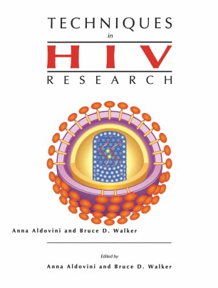 phd hiv research