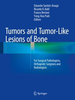Tumors And Tumor Like Lesions Of Bone Springerlink