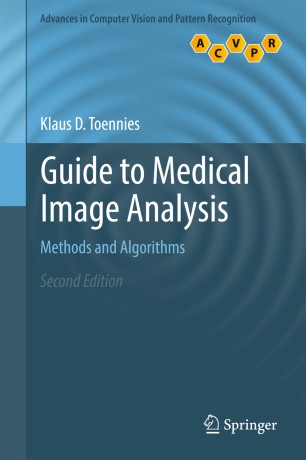 Guide To Medical Image Analysis Springerlink