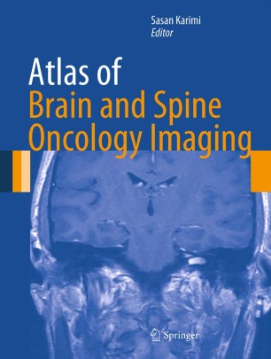 Atlas Of Brain And Spine Oncology Imaging Springerlink