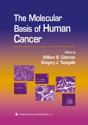 The Molecular Basis Of Human Cancer Springerlink