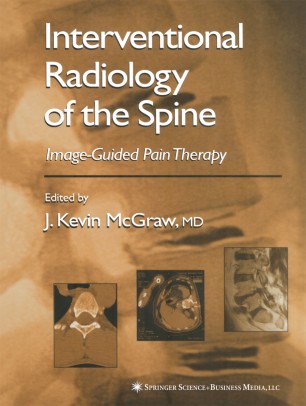 Interventional Radiology Of The Spine Springerlink