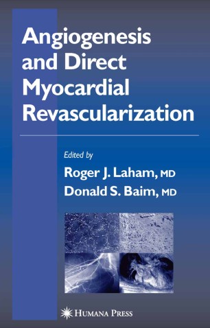 Angiogenesis and Direct Myocardial Revascularization | SpringerLink