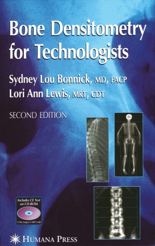 Bone Densitometry For Technologists Springerlink
