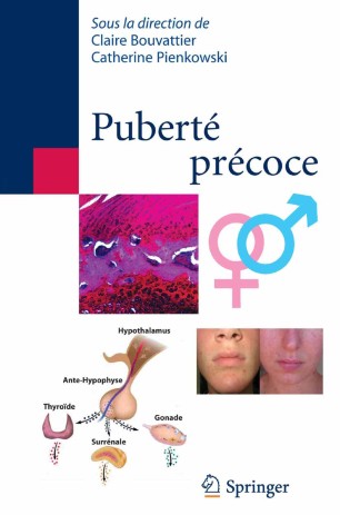 Puberte Precoce Springerlink