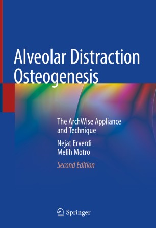 Alveolar Distraction Osteogenesis Book Cover