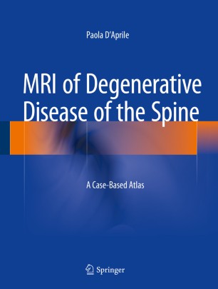 Mri Of Degenerative Disease Of The Spine Springerlink