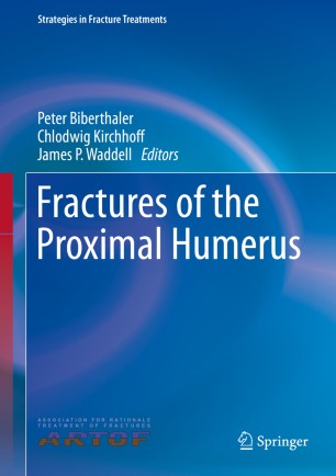 Fractures Of The Proximal Humerus Springerlink