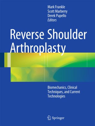 Reverse Shoulder Arthroplasty Springerlink