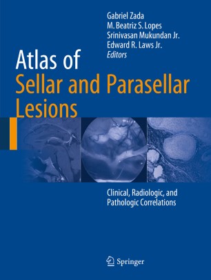 Atlas Of Sellar And Parasellar Lesions Springerlink
