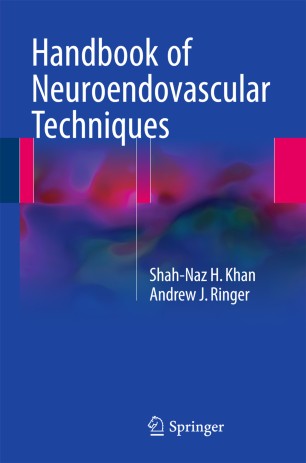 handbook - Handbook of Neuroendovascular Techniques 978-3-319-52936-3