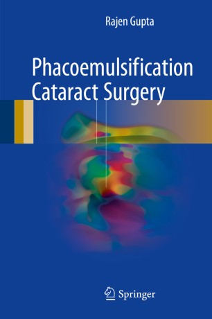 Phacoemulsification Cataract Surgery | SpringerLink