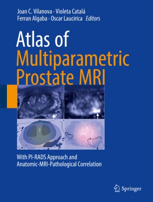 prostatitis mri pi rads