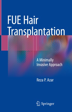 Fue Hair Transplantation Springerlink